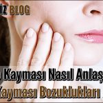 Çene Kayması Nasıl Anlaşılır