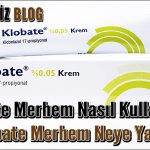 Klobate Merhem Nasıl Kullanılır